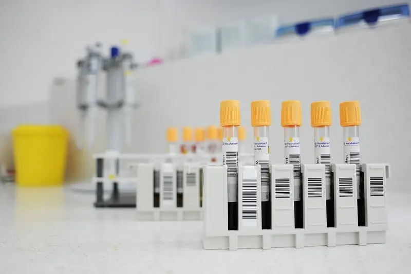 Epruvete s uzorcima krvi i barkod naljepnicama u stalku na radnoj plohi laboratorija